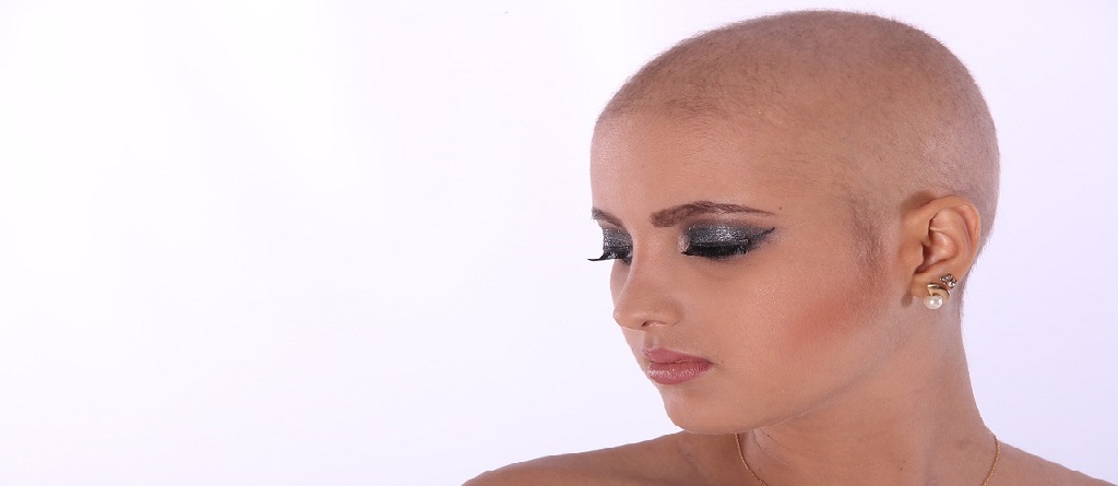 bald woman
